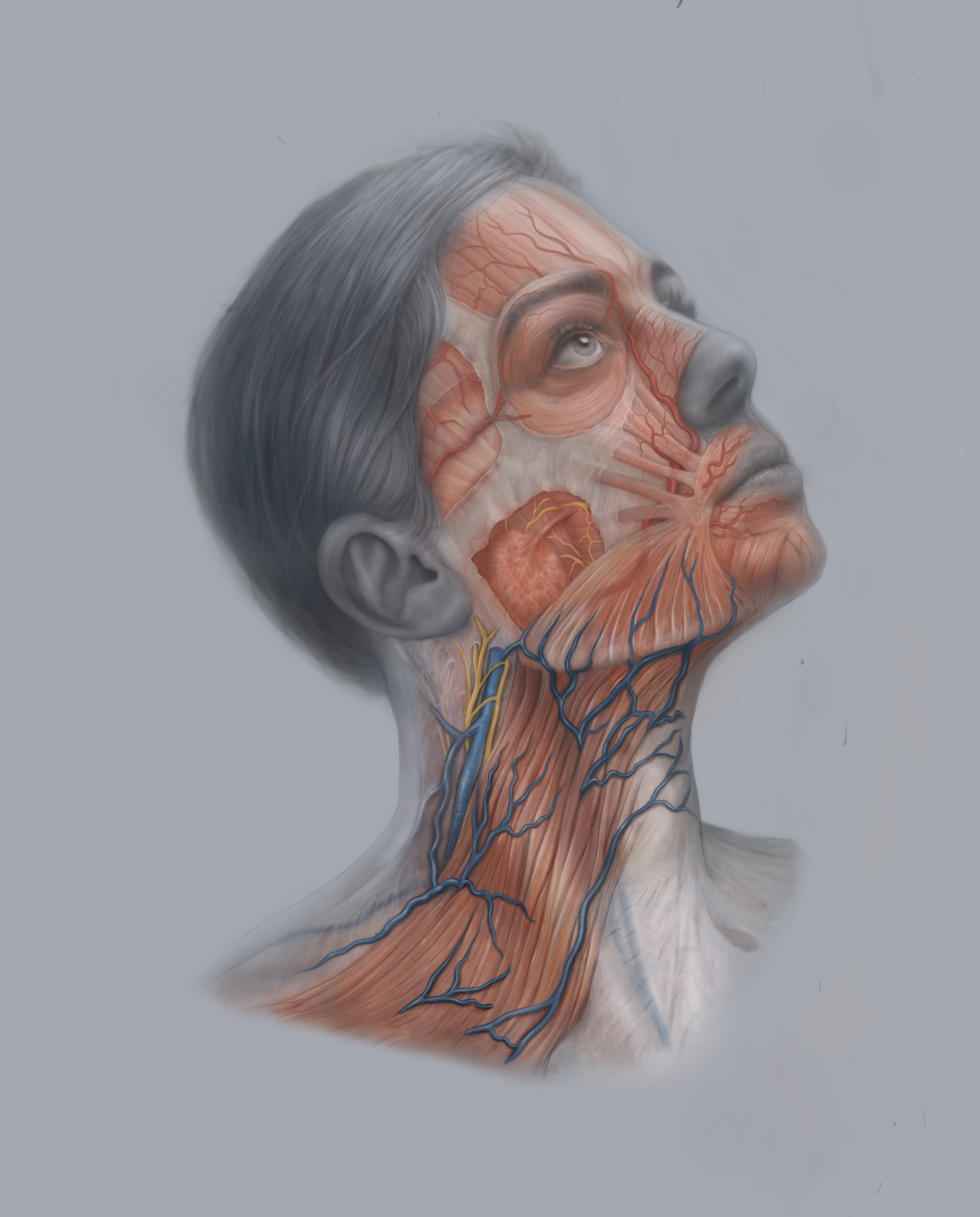 Neck dissection